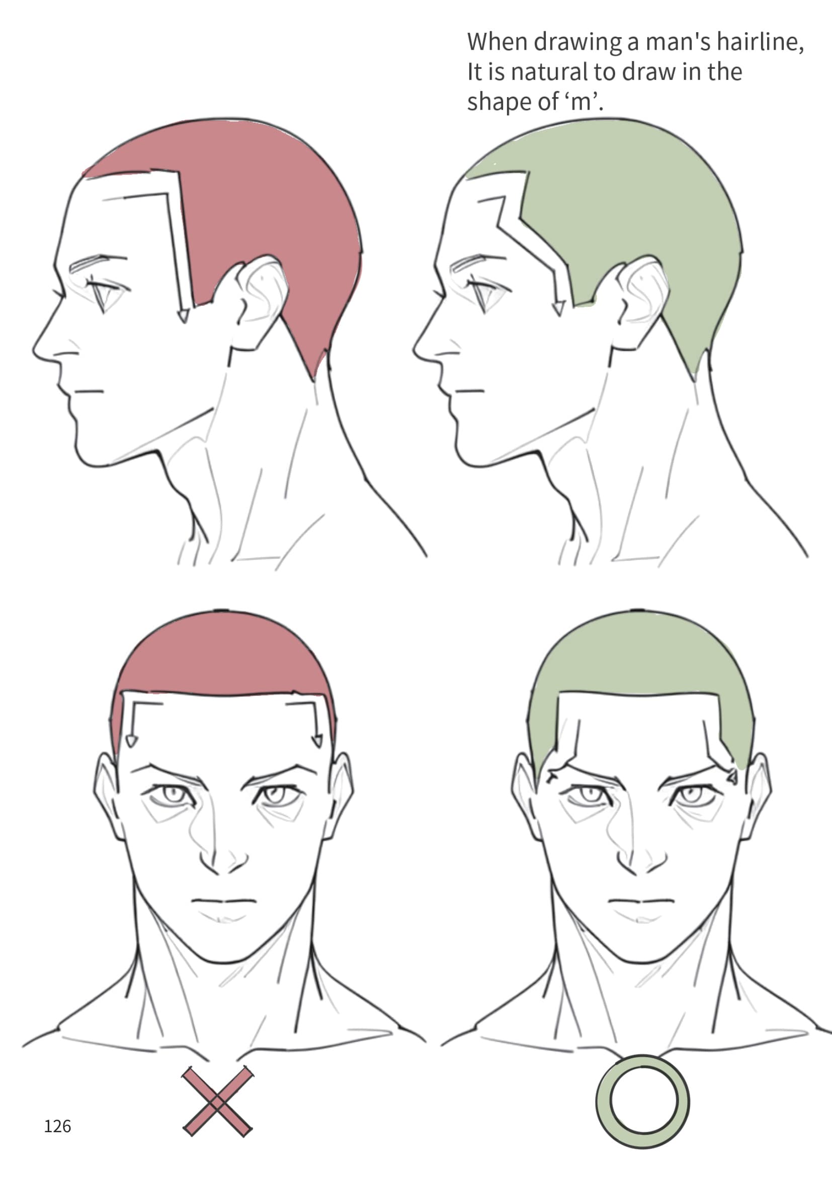 Male Hairline