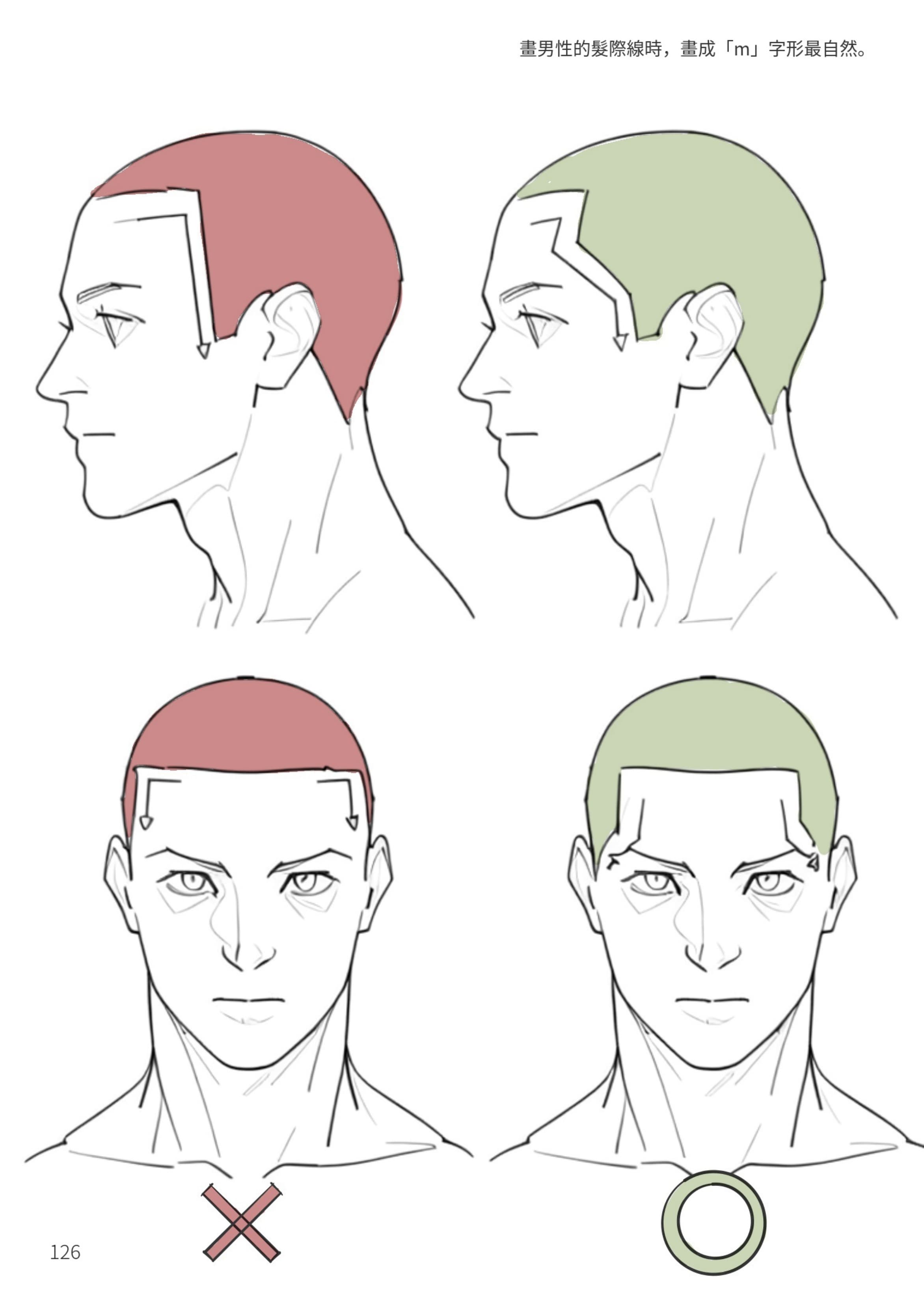 男性髮際線